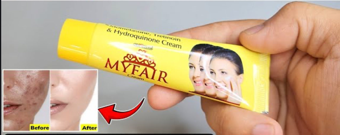 Myfair Cream 20gm (Special offer buy 2 get 1 free)